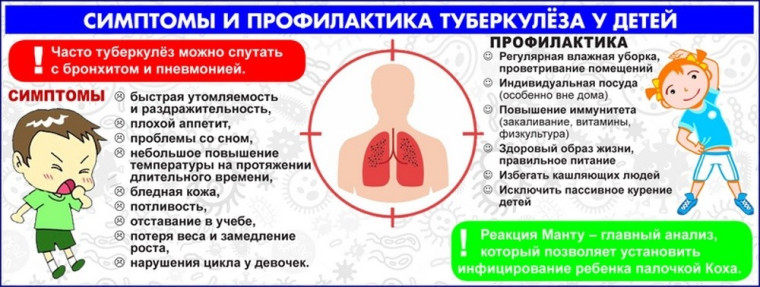 Профилактика туберкулеза.